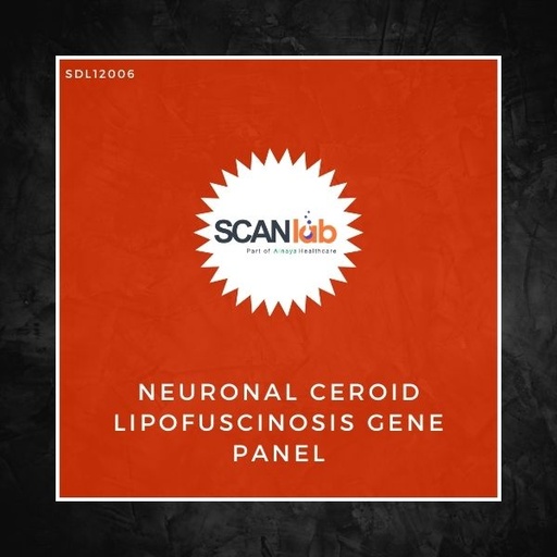 [SDL12006] NEURONAL CEROID LIPOFUSCINOSIS GENE PANEL (SDL12006)