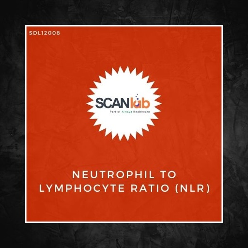 [SDL12008] NEUTROPHIL TO LYMPHOCYTE RATIO (NLR) (SDL12008)