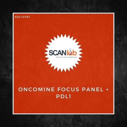 [SDL12081] ONCOMINE FOCUS PANEL+PDL1 (SDL12081)