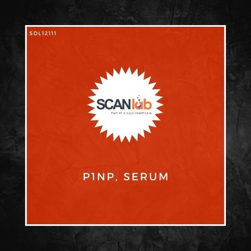 [SDL12111] P1NP, SERUM (SDL12111)