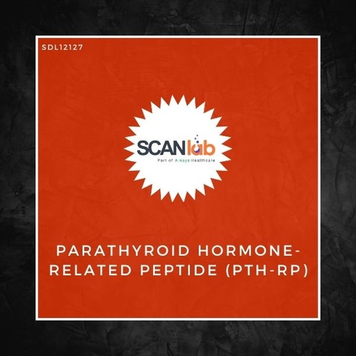 [SDL12127] PARATHYROID HORMONE-RELATED PEPTIDE(PTH-RP) (SDL12127)