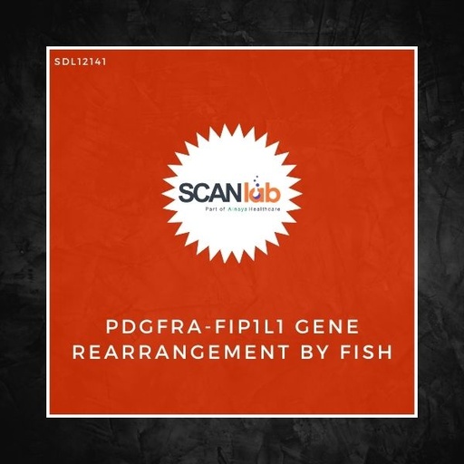 [SDL12141] PDGFRA-FIP1L1 GENE REARRANGEMENT BY FISH (SDL12141)