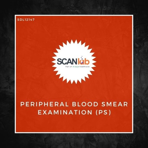[SDL12147] PERIPHERAL BLOOD SMEAR EXAMINATION (PS) (SDL12147)
