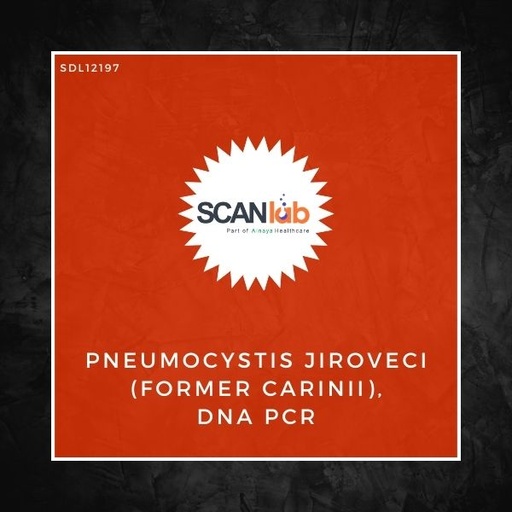 [SDL12197] PNEUMOCYSTIS JIROVECI (FORMER CARINII), DNA PCR (SDL12197)