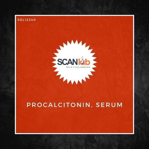 [SDL12240] PROCALCITONIN, SERUM (SDL12240)