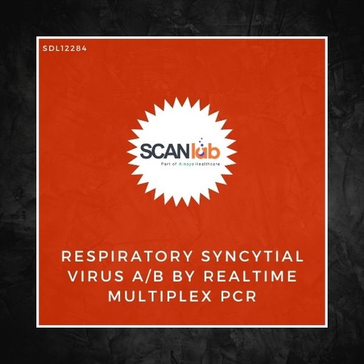 [SDL12284] RESPIRATORY SYNCYTIAL VIRUS A/B BY REALTIME MULTIPLEX PCR (SDL12284)