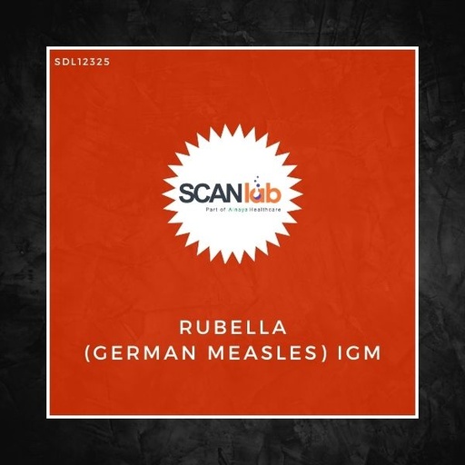 [SDL12325] RUBELLA (GERMAN MEASLES) IGM (SDL12325)