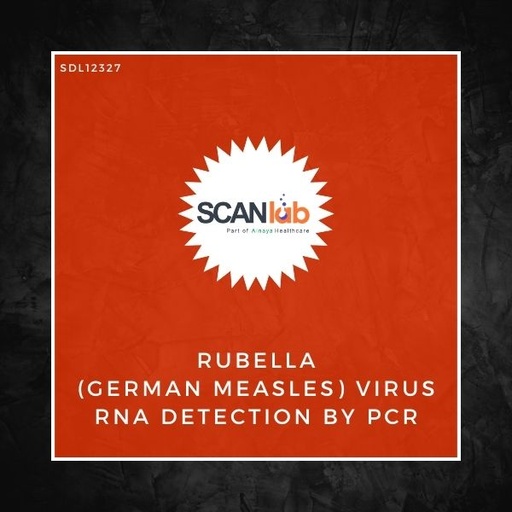 [SDL12327] RUBELLA (GERMAN MEASLES) VIRUS RNA DETECTION BY PCR (SDL12327)