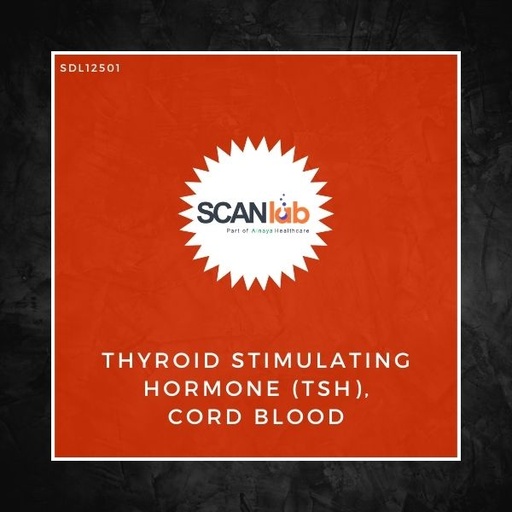 [SDL12501] THYROID STIMULATING HORMONE (TSH), CORD BLOOD (SDL12501)
