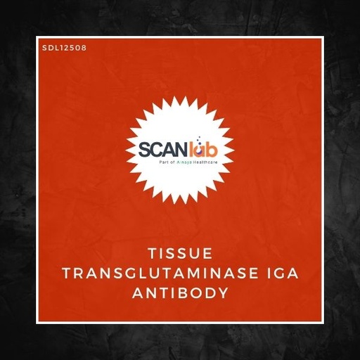 [SDL12508] TISSUE TRANSGLUTAMINASE (TTG) IGA ANTIBODY (SDL12508)