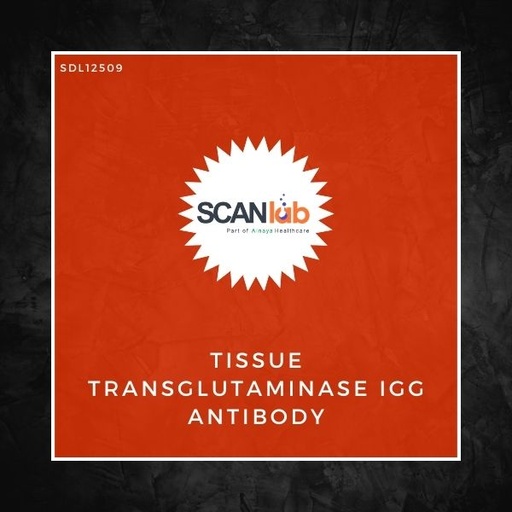 [SDL12509] TISSUE TRANSGLUTAMINASE IGG ANTIBODY (ANTI TTG IGG) (SDL12509)