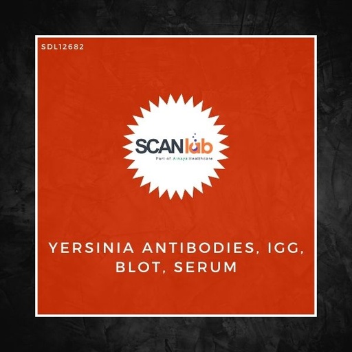 [SDL12682] YERSINIA ANTIBODIES, IGG, BLOT, SERUM (SDL12682)