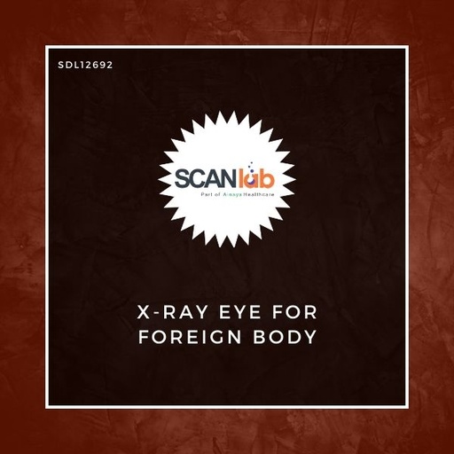 [SDL12692] X-RAY EYE FOR FOREIGN BODY (SDL12692)