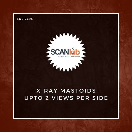 [SDL12695] X-RAY MASTOIDS UPTO 2 VIEWS PER SIDE (SDL12695)