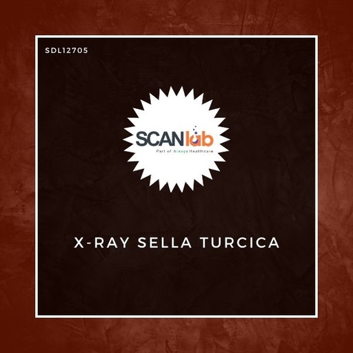 [SDL12705] X-RAY SELLA TURCICA (SDL12705)