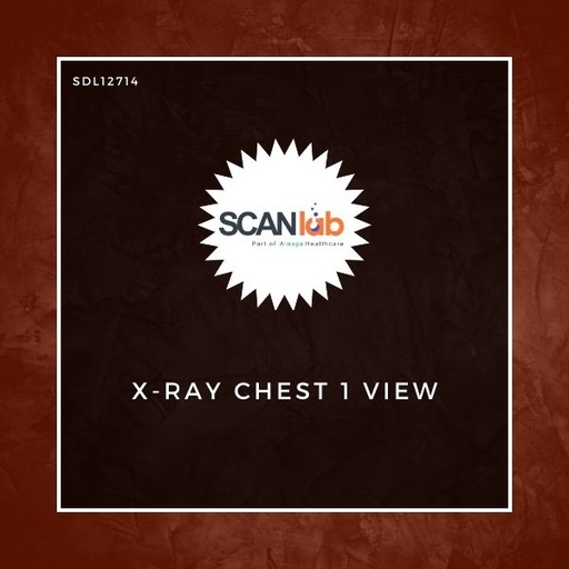[SDL12714] X-RAY CHEST 1 VIEW (SDL12714)