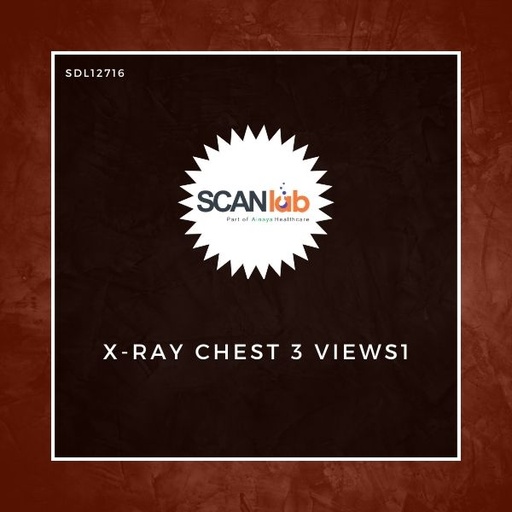 [SDL12716] X-RAY CHEST 3 VIEWS1 (SDL12716)