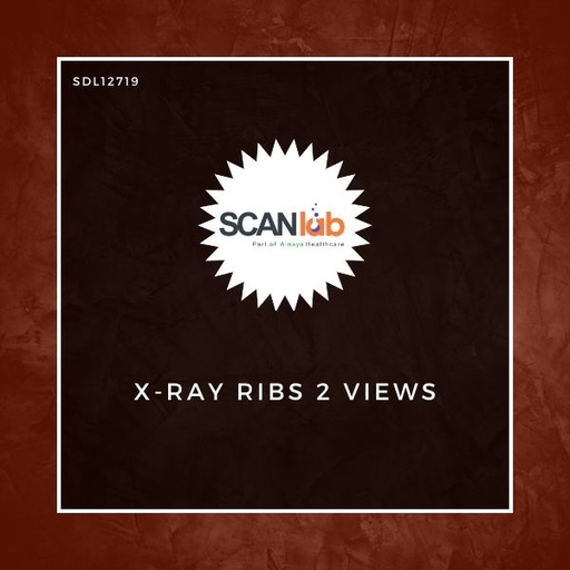 [SDL12719] X-RAY RIBS 2 VIEWS (SDL12719)