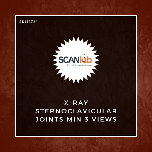 [SDL12724] X-RAY STERNOCLAVICULAR JOINTS MIN 3 VIEWS (SDL12724)