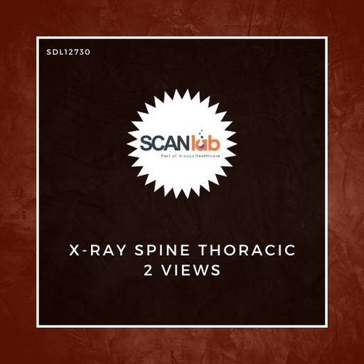 [SDL12730] X-RAY SPINE THORACIC 2 VIEWS (SDL12730)