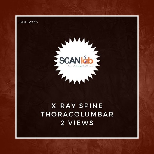 [SDL12733] X-RAY SPINE THORACOLUMBAR 2 VIEWS (SDL12733)
