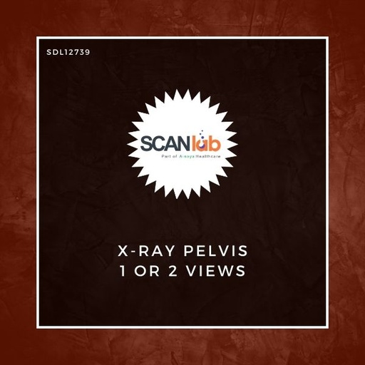 [SDL12739] X-RAY PELVIS 1 OR 2 VIEWS (SDL12739)