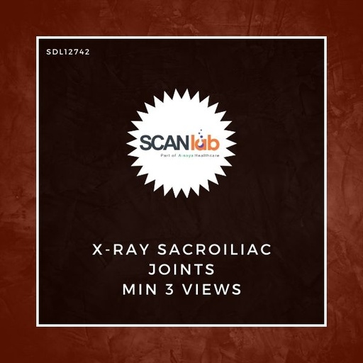 [SDL12742] X-RAY SACROILIAC JOINTS MIN 3 VIEWS (SDL12742)