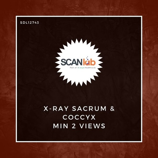[SDL12743] X-RAY SACRUM & COCCYX MIN 2 VIEWS (SDL12743)