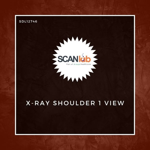 [SDL12746] X-RAY SHOULDER 1 VIEW (SDL12746)