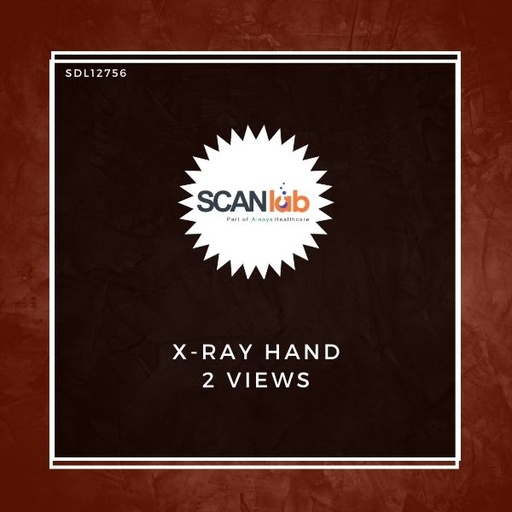 [SDL12756] X-RAY HAND 2 VIEWS (SDL12756)