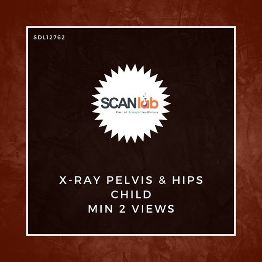 [SDL12762] X-RAY PELVIS & HIPS CHILD MIN 2 VIEWS (SDL12762)