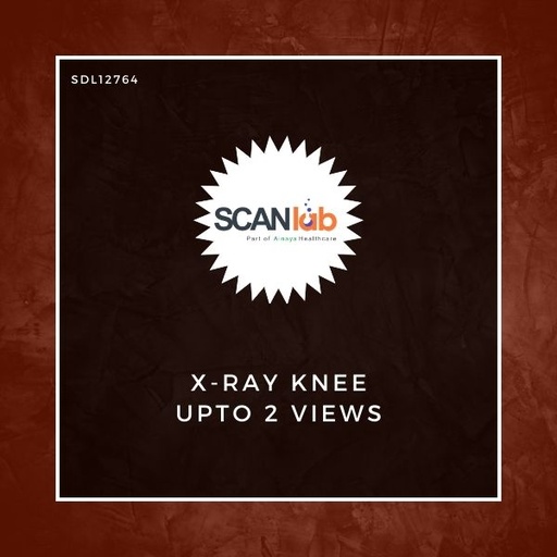 [SDL12764] X-RAY KNEE UPTO 2 VIEWS (SDL12764)