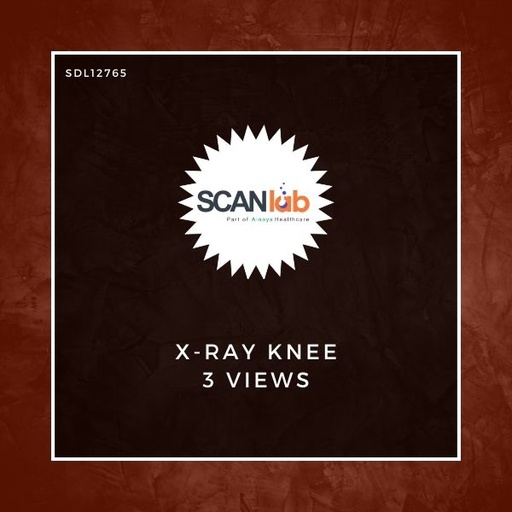 [SDL12765] X-RAY KNEE 3 VIEWS (SDL12765)