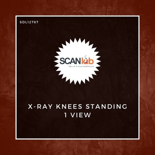 [SDL12767] X-RAY KNEES STANDING 1 VIEW (SDL12767)