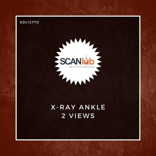 [SDL12770] X-RAY ANKLE 2 VIEWS (SDL12770)