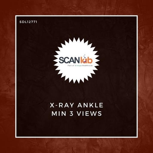 [SDL12771] X-RAY ANKLE MIN 3 VIEWS (SDL12771)