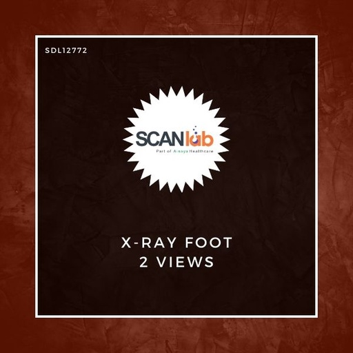 [SDL12772] X-RAY FOOT 2 VIEWS (SDL12772)