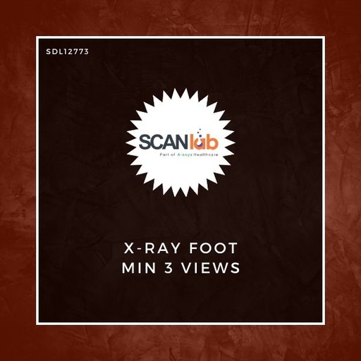 [SDL12773] X-RAY FOOT MIN 3 VIEWS (SDL12773)