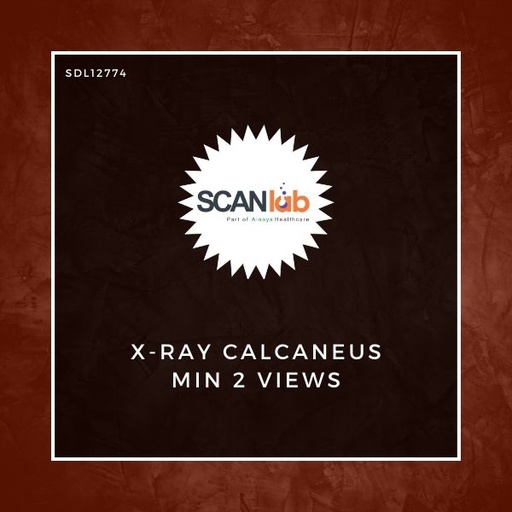 [SDL12774] X-RAY CALCANEUS MIN 2 VIEWS (SDL12774)