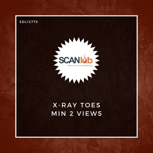 [SDL12775] X-RAY TOES MIN 2 VIEWS (SDL12775)