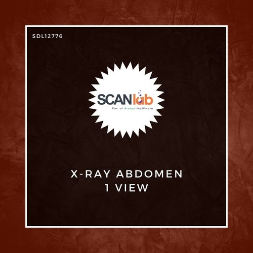 [SDL12776] X-RAY ABDOMEN 1 VIEW (SDL12776)