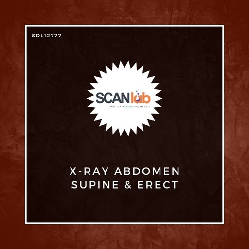 [SDL12777] X-RAY ABDOMEN SUPINE & ERECT (SDL12777)