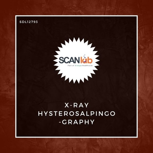 [SDL12793] X-RAY HYSTEROSALPINGOGRAPHY (SDL12793)