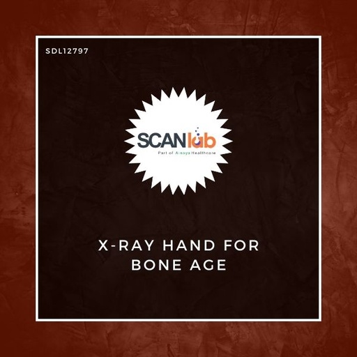 [SDL12797] X-RAY HAND FOR BONE AGE (SDL12797)