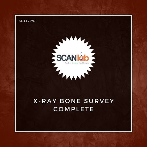 [SDL12798] X-RAY BONE SURVEY COMPLETE (SDL12798)