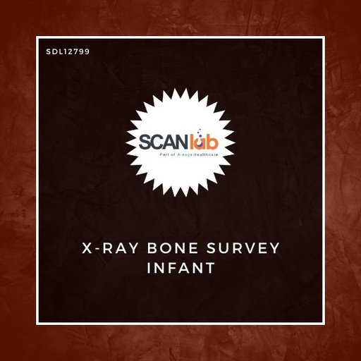 [SDL12799] X-RAY BONE SURVEY INFANT (SDL12799)