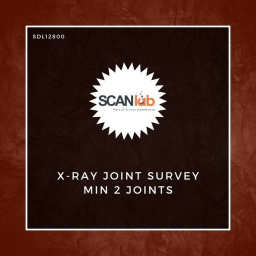 [SDL12800] X-RAY JOINT SURVEY MIN 2 JOINTS (SDL12800)