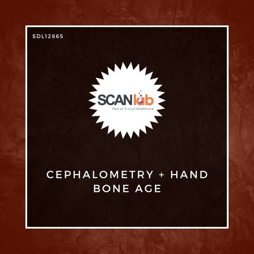 [SDL12865] CEPHALOMETRY+HAND BONE AGE (SDL12865)
