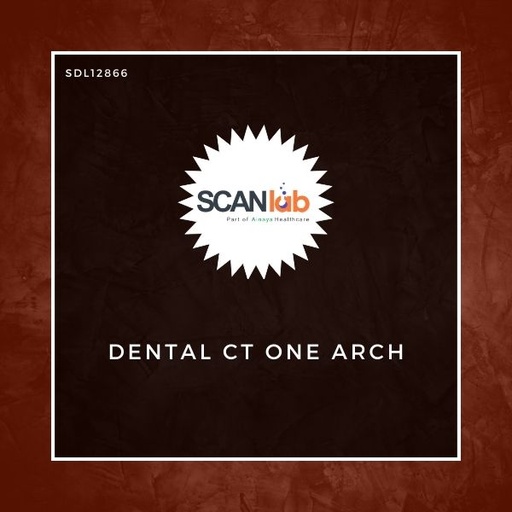 [SDL12866] DENTAL CT ONE ARCH (SDL12866)