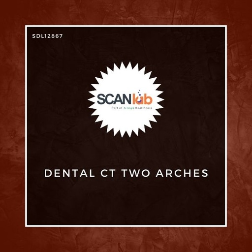 [SDL12867] DENTAL CT TWO ARCHES (SDL12867)
